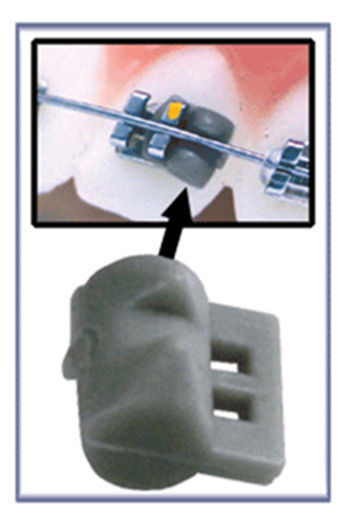 ROTATION WEDGES Orthodontic Rotator Elastic – 100 per Pack BARRIL DE ROTACION