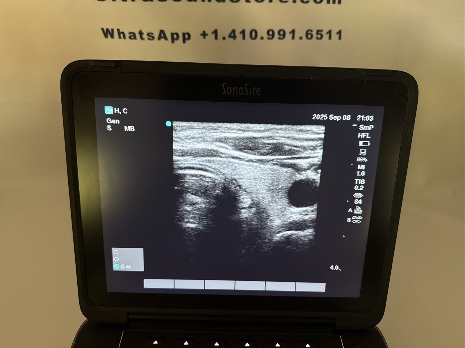SONOSITE EDGE II 2018 Phased & Linear Transducers. 60 Day Money Back Guarantee