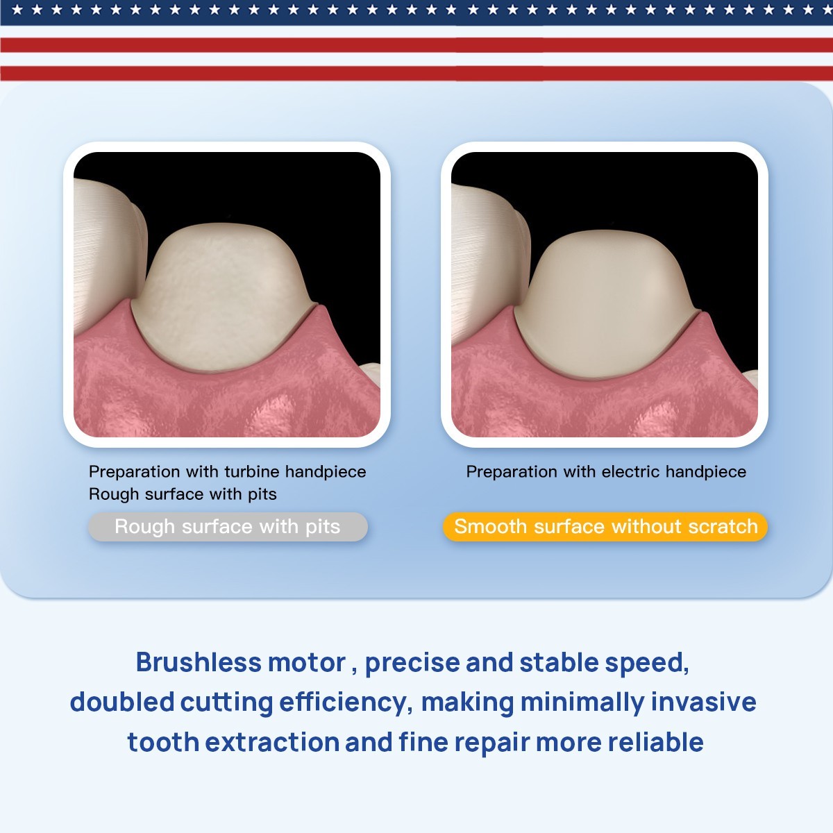 AZDENT Dental Brushless LED Electric Micro Motor w/Water/1:5 Increaing Handpiece