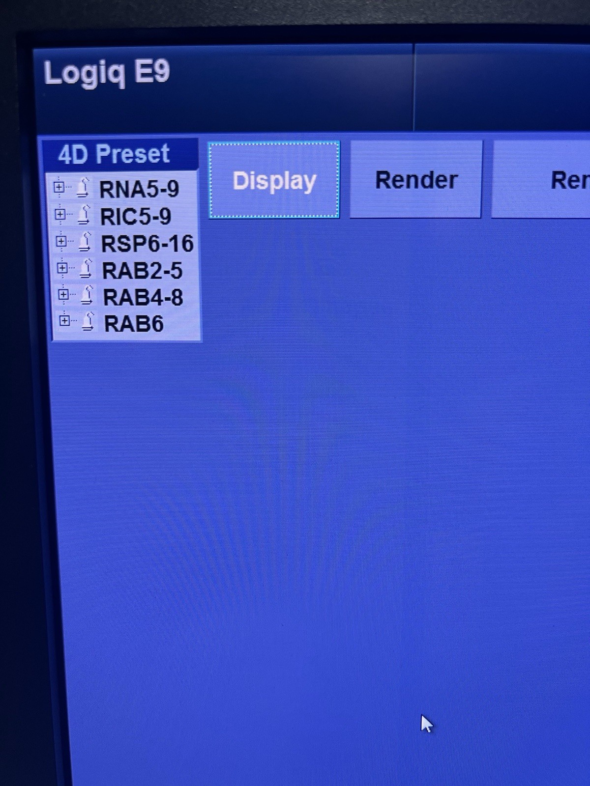 2017 GE LOGIQ E9 R6 Ultrasound | XDclear 2.0 |All Options | Warranty