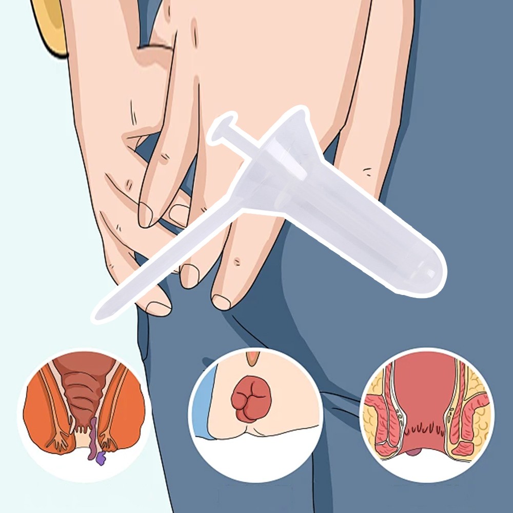 10pcs Disposable Anoscopes Proctoscope Sterile Gynecology Urology Instrument