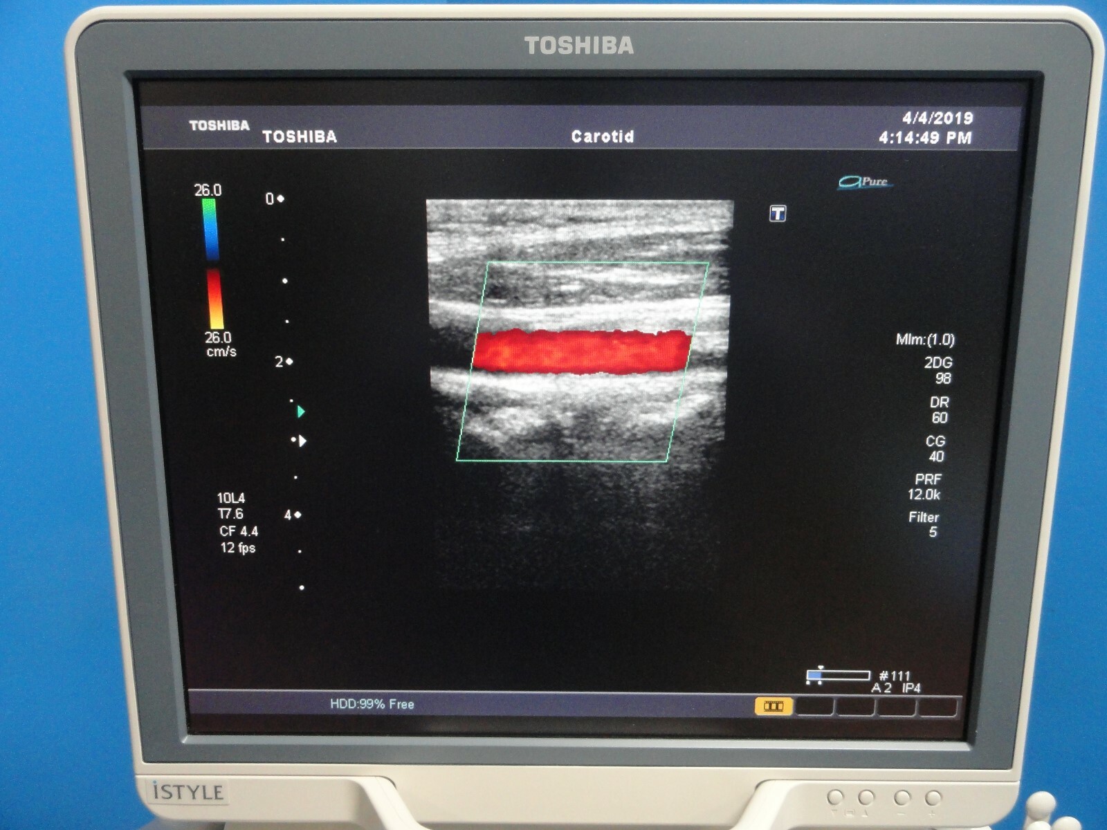 2008 TOSHIBA PLT-604AT LINEAR ARRAY PROBE (TOSHIBA APLIO & XARIO SERIES) ~15766