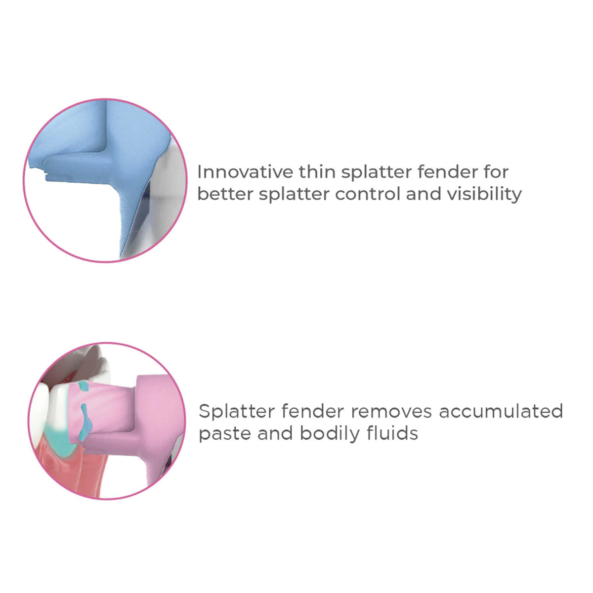PacDent AntiSplatr Prophy Angles (Pkg. 100)