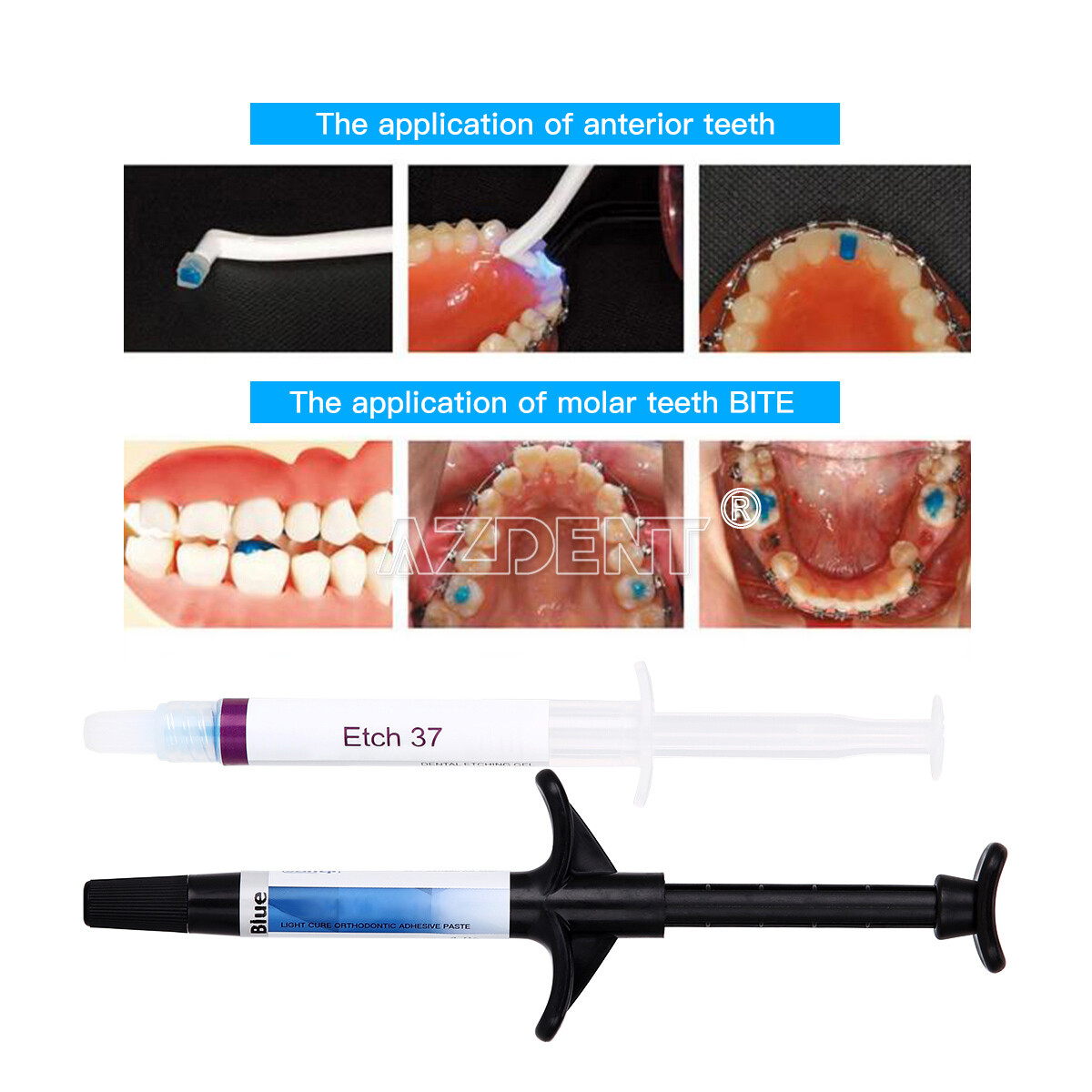 Dental Orthodontic Adhesive Light Cure Band Cement Blue Glue Intro Kit Blue