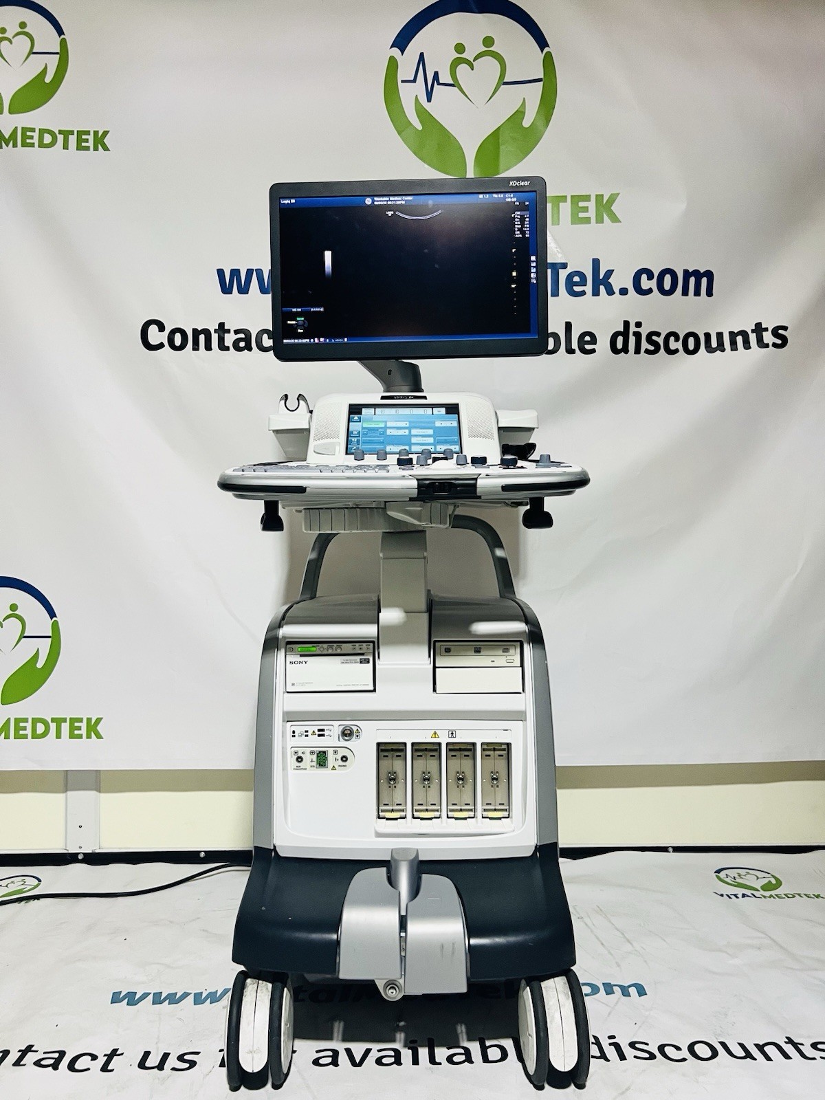 2017 GE LOGIQ E9 R6 Ultrasound | XDclear 2.0 |All Options | Warranty