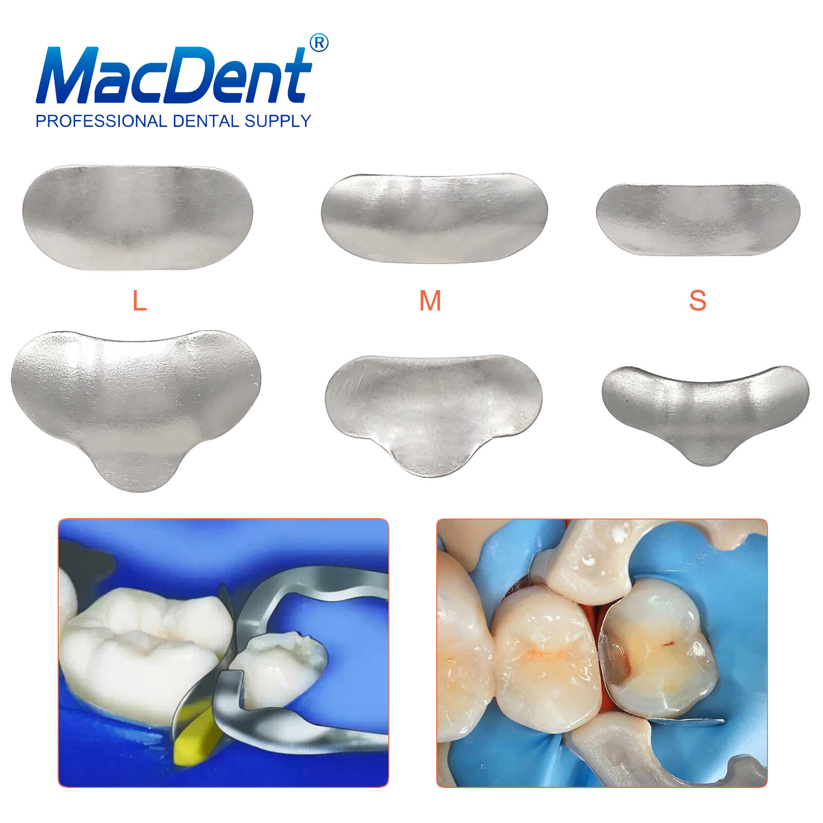 Dental Sectional Matrix System Contoured Metal Matrices Refill Matrix Bands 50x