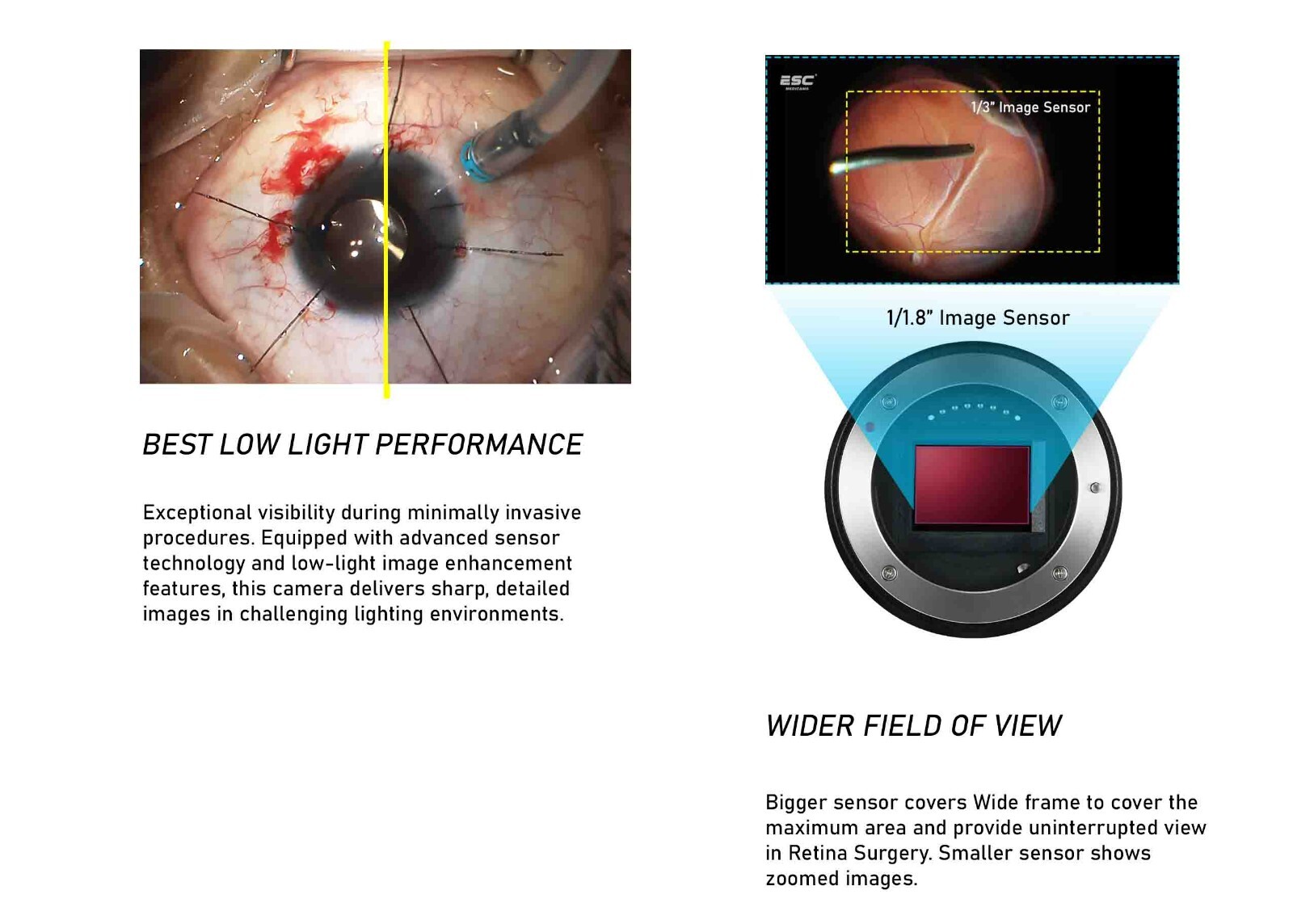 Surgical Microscope camera with Recorder for Zeiss, Leica, Takagi Beam Splitter
