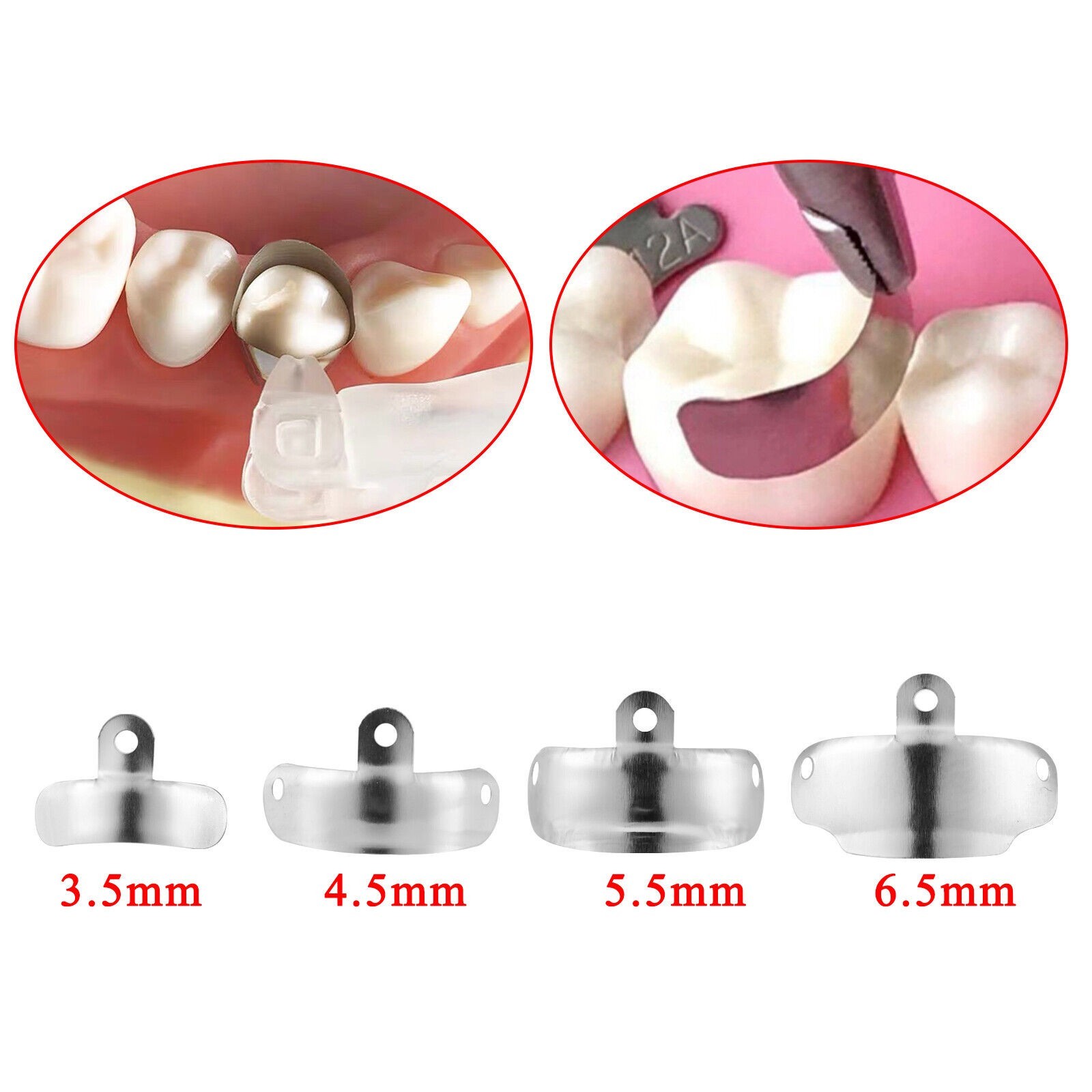 50Pcs Dental Matrix Bands Palodent V3 Style Sectional Contoured Matrices 16 Size