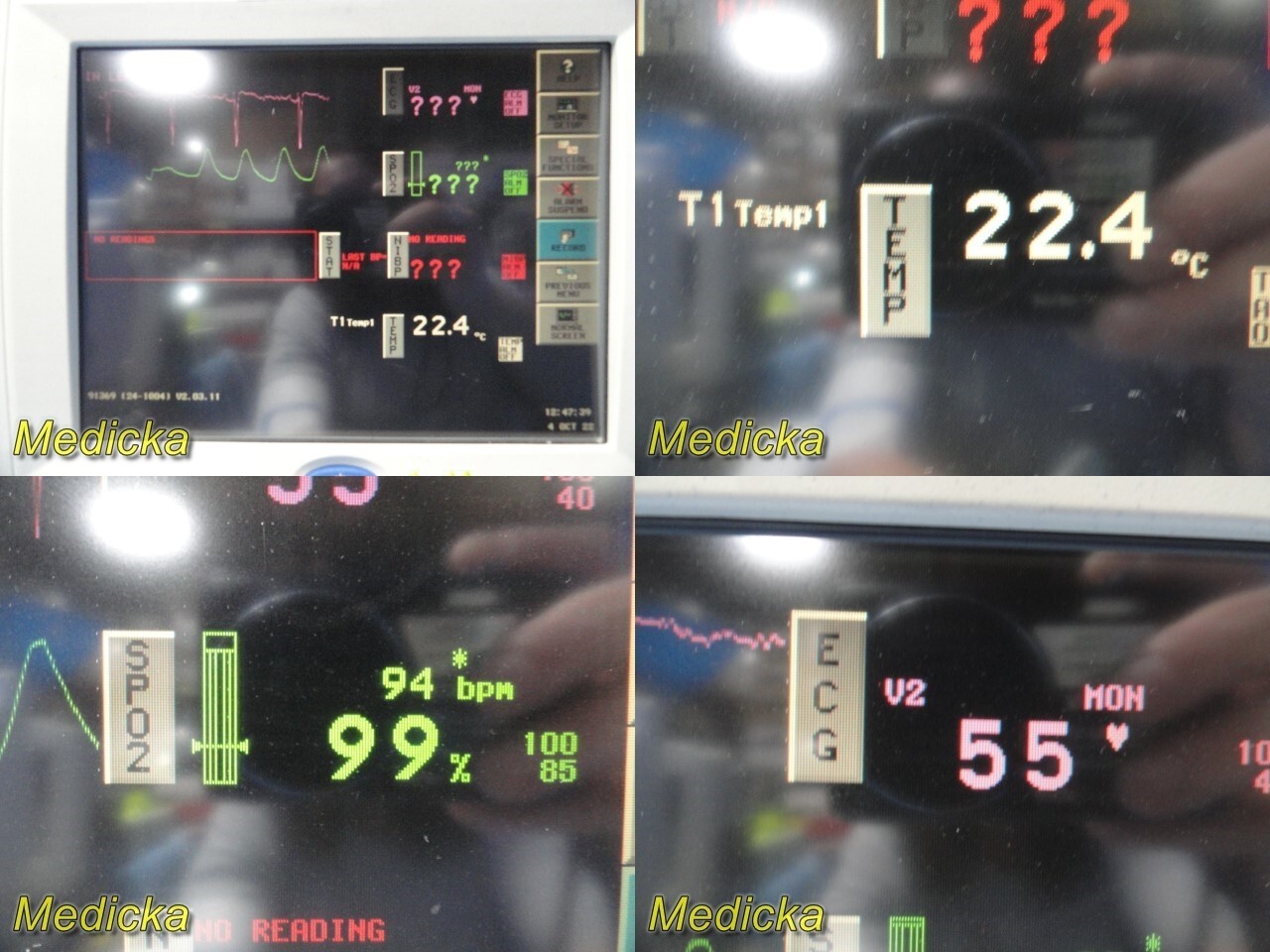 Spacelabs 91496 Multiparameter COMMAND Module ONLY, SOFTWARE V2.01.07 /06 ~29601