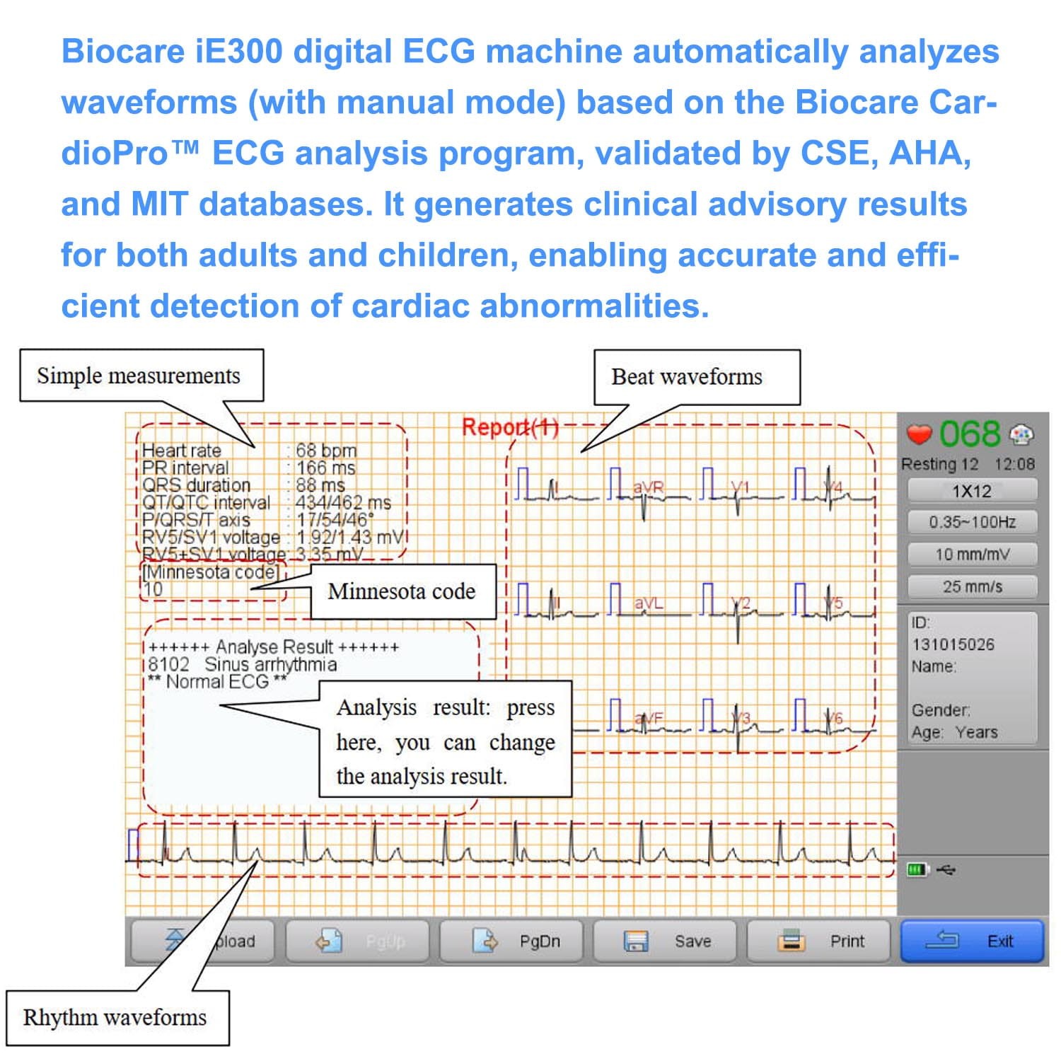 12 Lead ECG/EKG Machine w Interpretation Electrocardiograph Auto-analysed Result