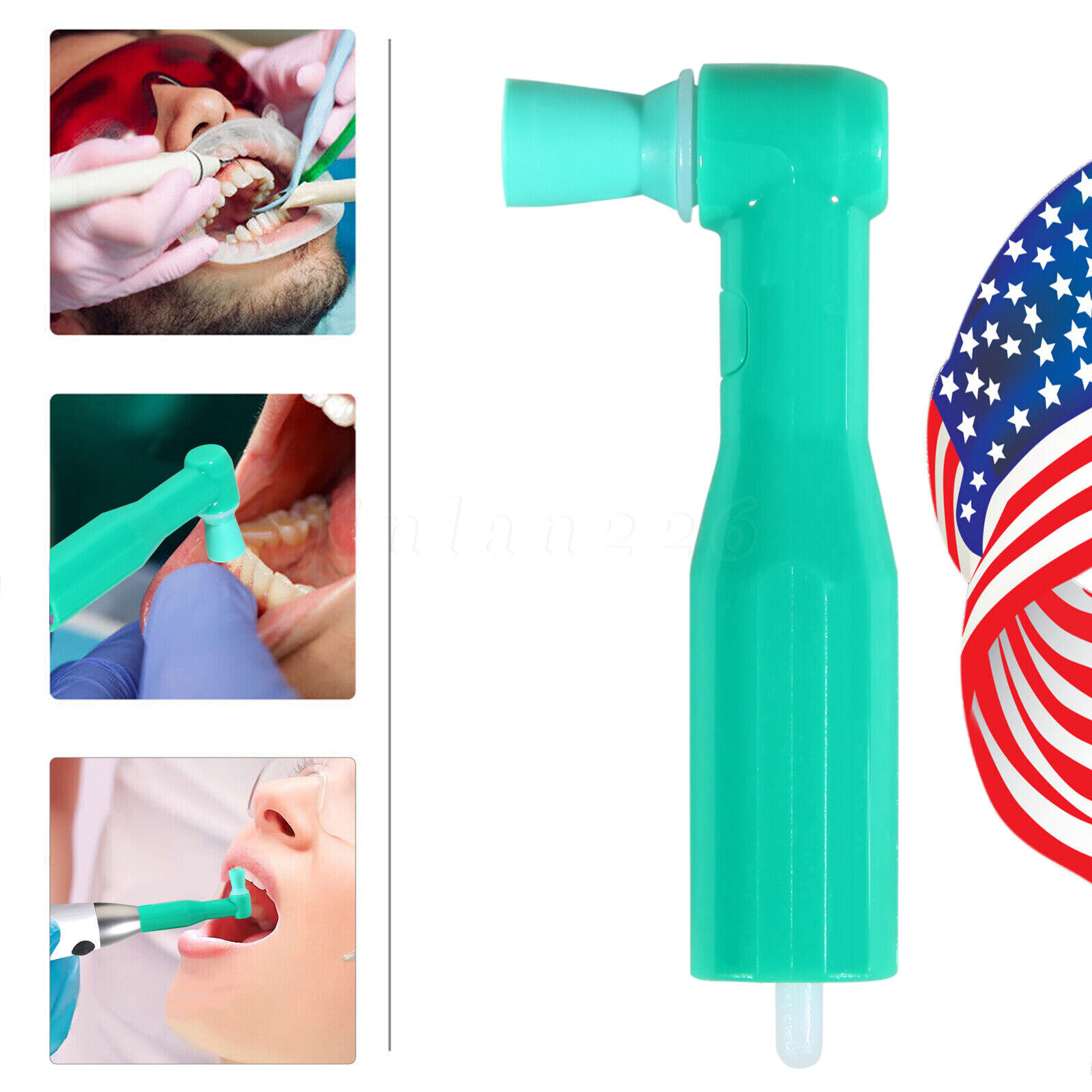 DISPOSABLE PROPHY ANGLES BX/100 SOFT CUP Dental