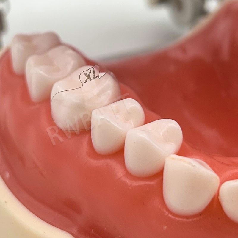 Dental Matrix Bands Ring Sectional Matrix Clamp Clear Matrix Anterior Matrices