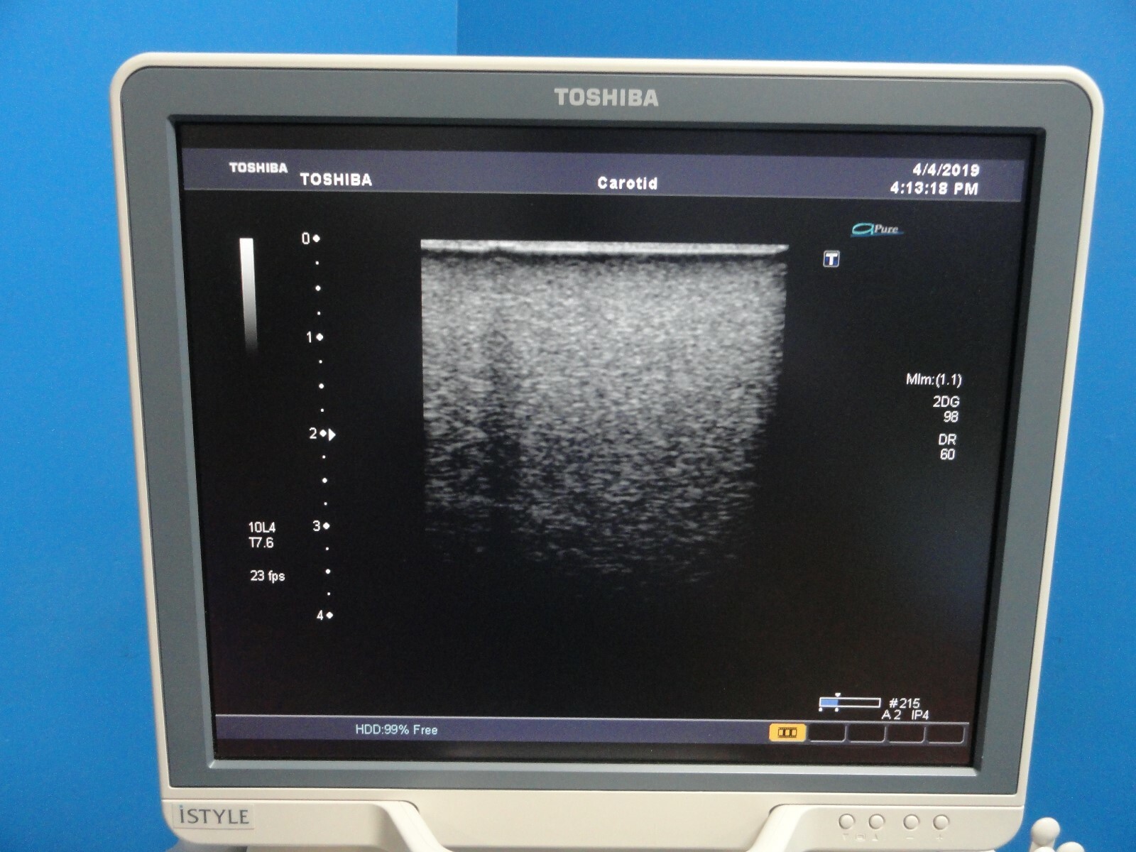 2008 TOSHIBA PLT-604AT LINEAR ARRAY PROBE (TOSHIBA APLIO & XARIO SERIES) ~15766