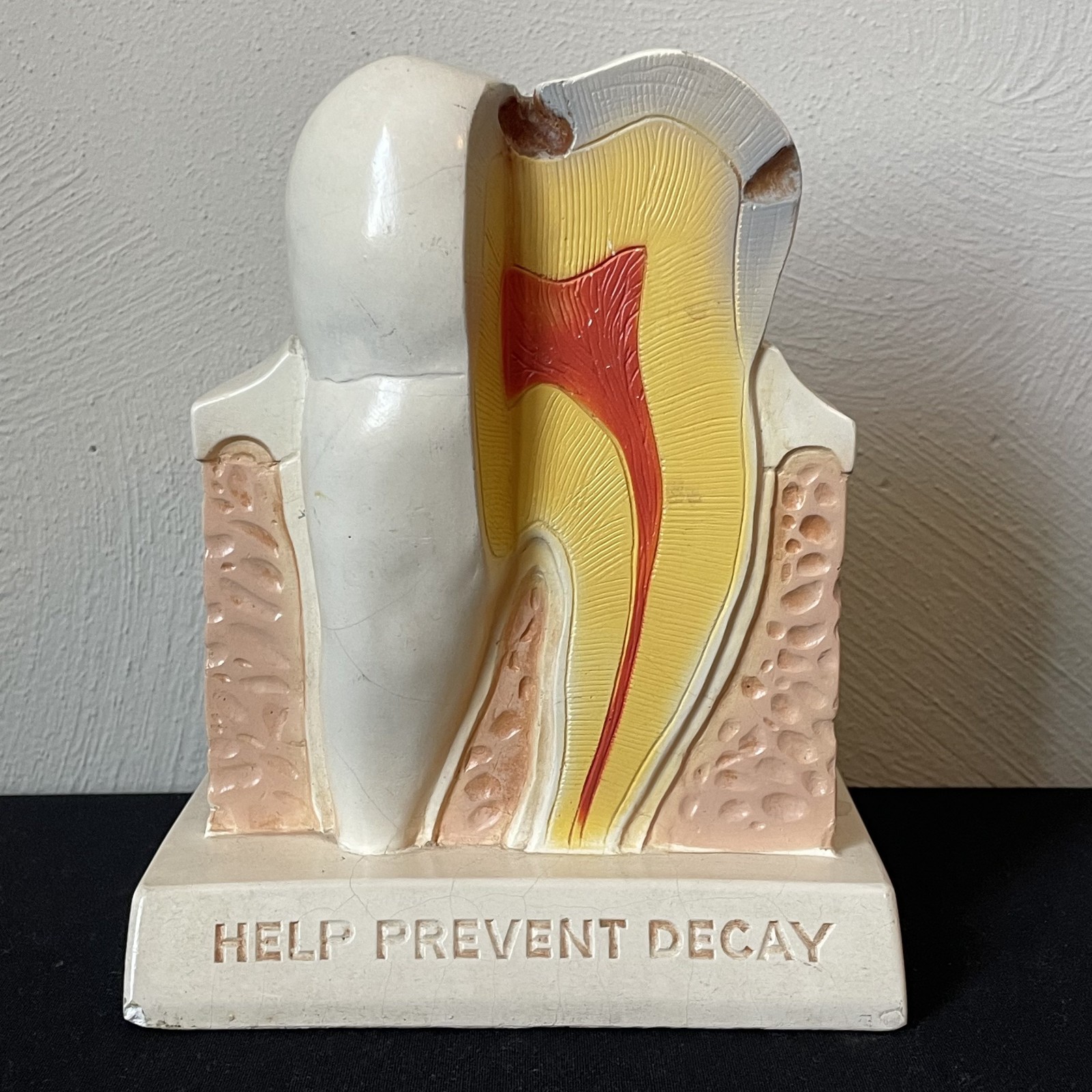 1960 Huge Tooth Model Advertising Dental Decay Molar Dentist Office Oddity Crest