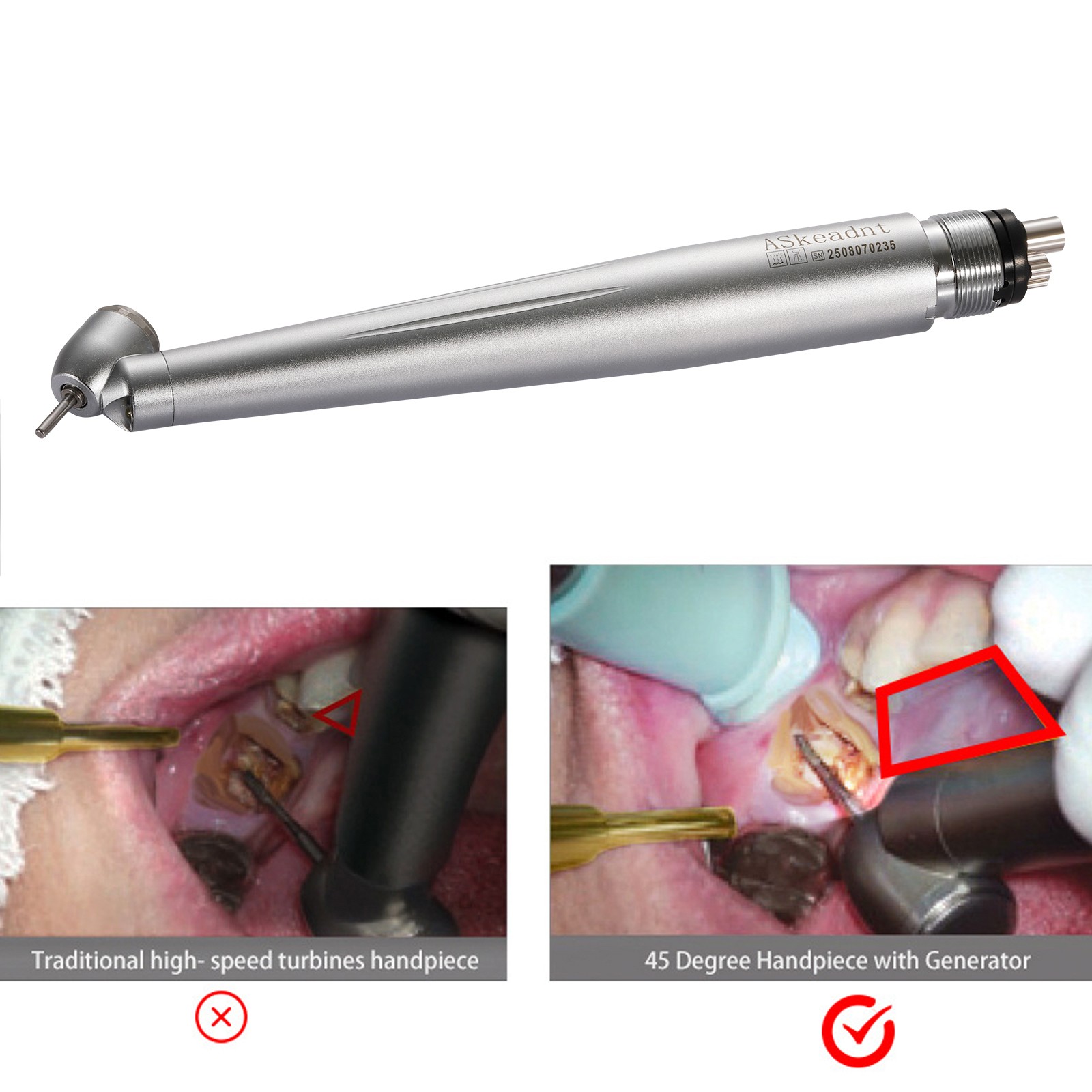 NSK Style SG20 Dental Implant 20:1 Reduction Contra Angle Handpiece Push Button