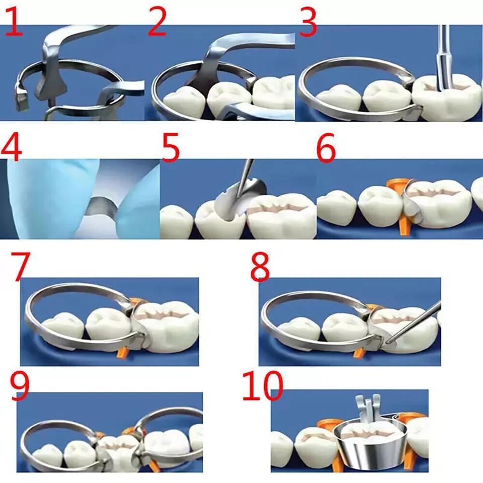 Dental Anterior Matrix Bands Sectional Contoured Twin Matrices Proximal Strips