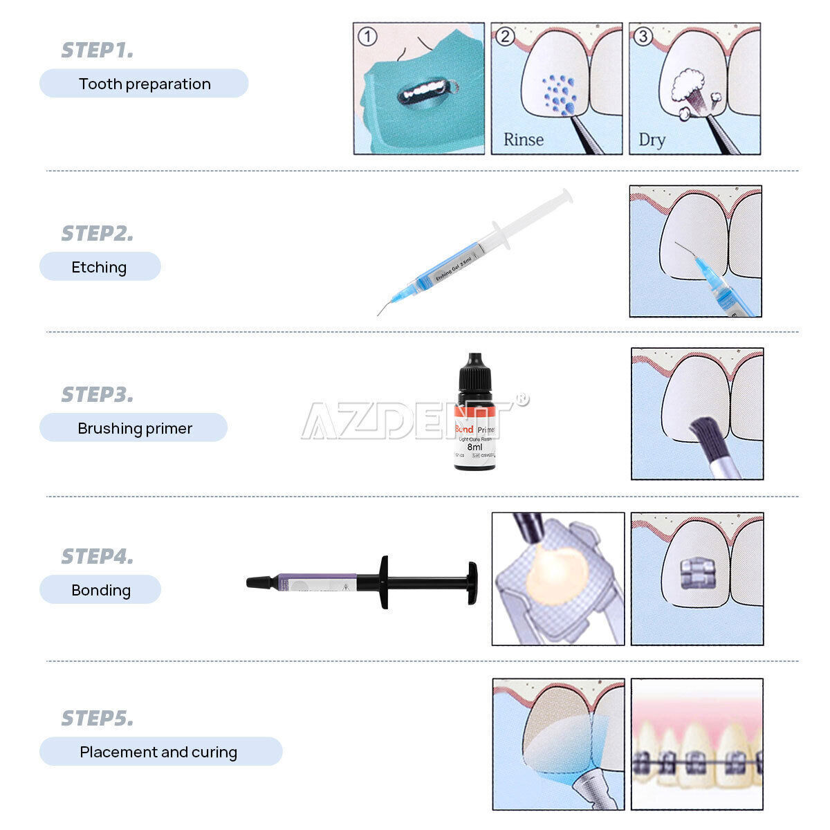 Dental Bracket Braces Glue Ortho Bonding Light Cure Resin Composite Kit