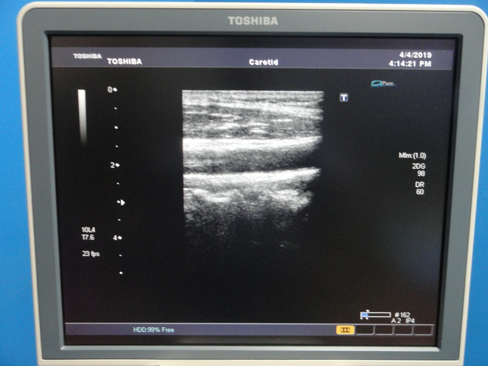 2008 TOSHIBA PLT-604AT LINEAR ARRAY PROBE (TOSHIBA APLIO & XARIO SERIES) ~15766
